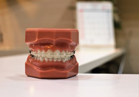 Orthodontic Braces - Toronto Bloor Dufferin Dental Office